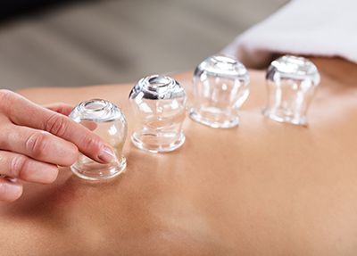 Best Cupping Massage in Naples, Florida